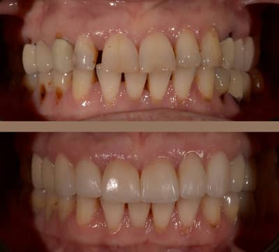 Slider image (1) UltimaDent